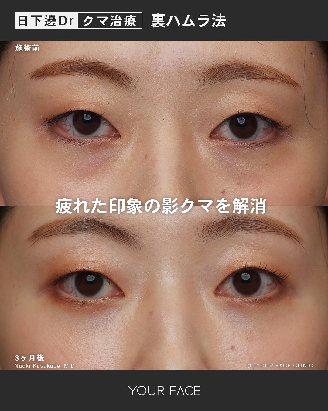 裏ハムラ