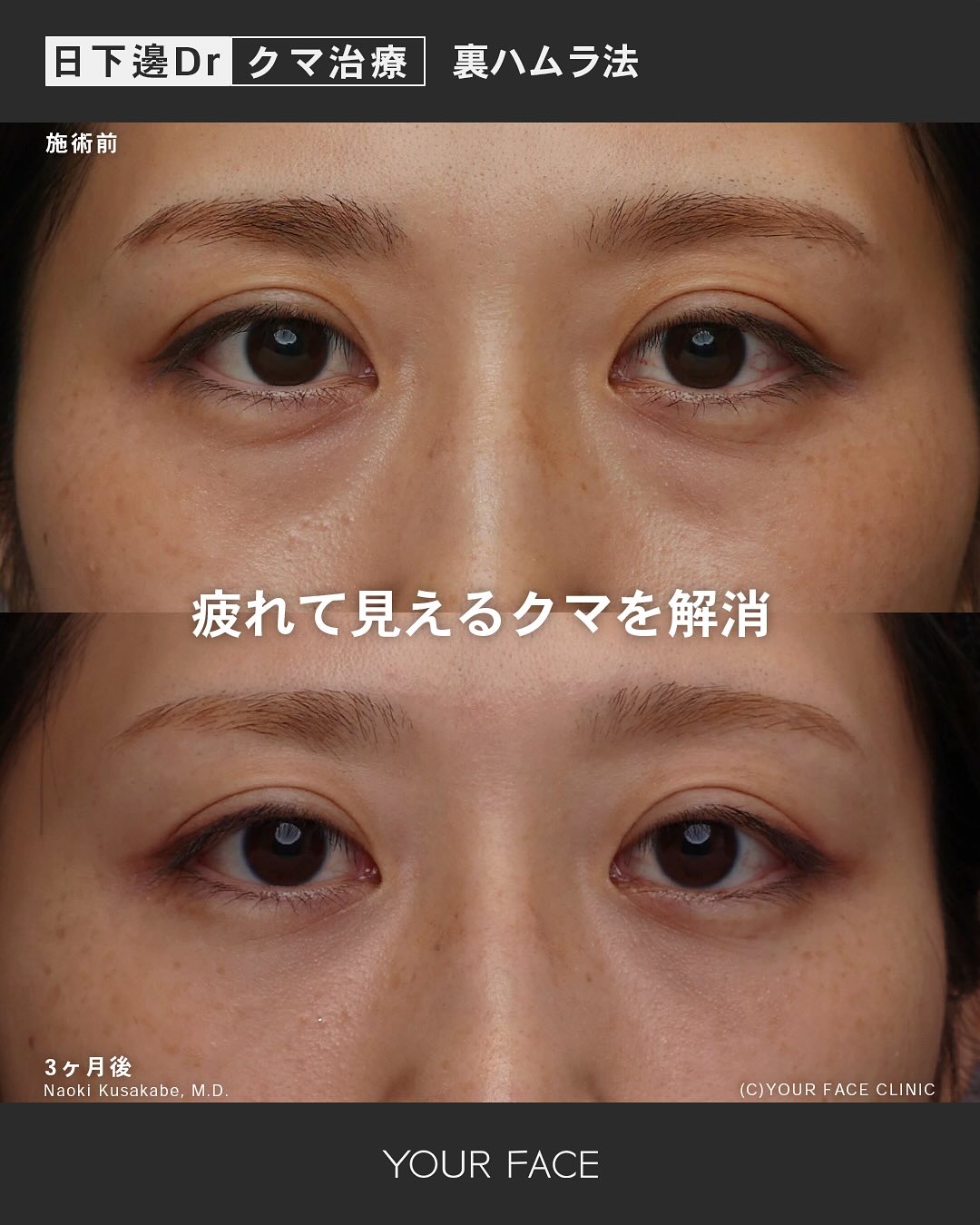 裏ハムラ