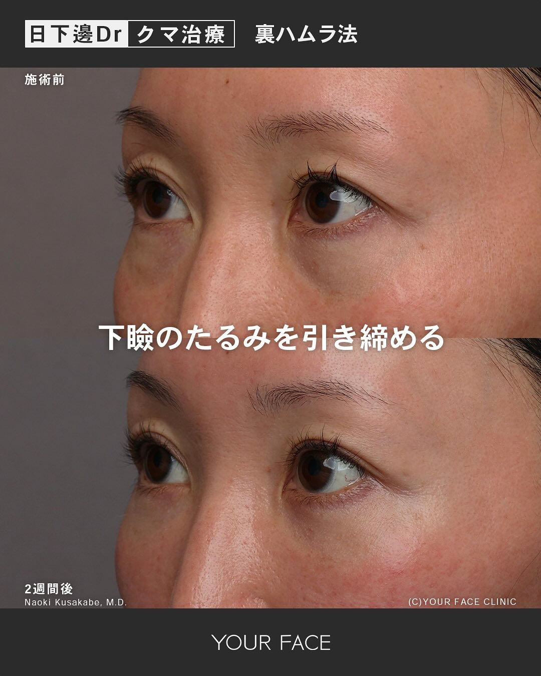 裏ハムラ