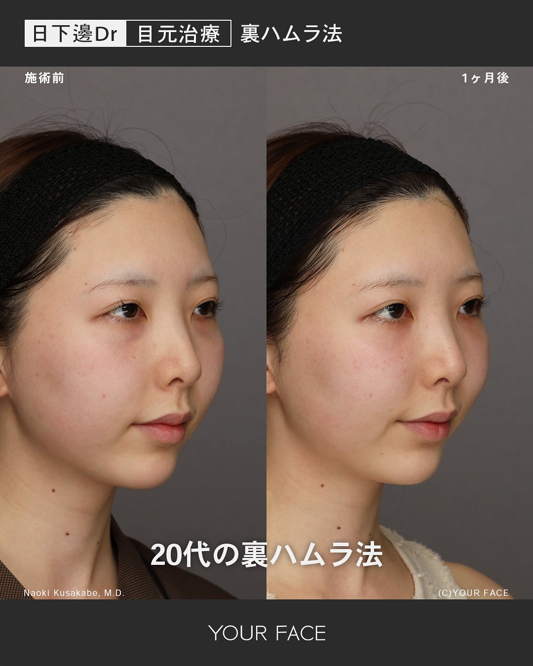 裏ハムラ