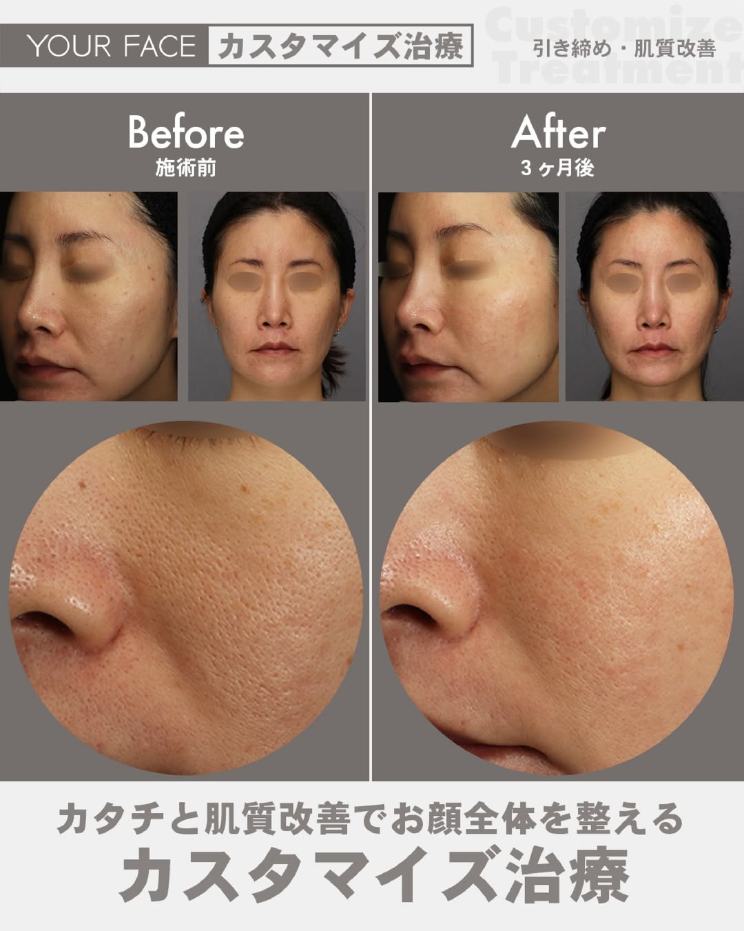 カスタマイズ治療