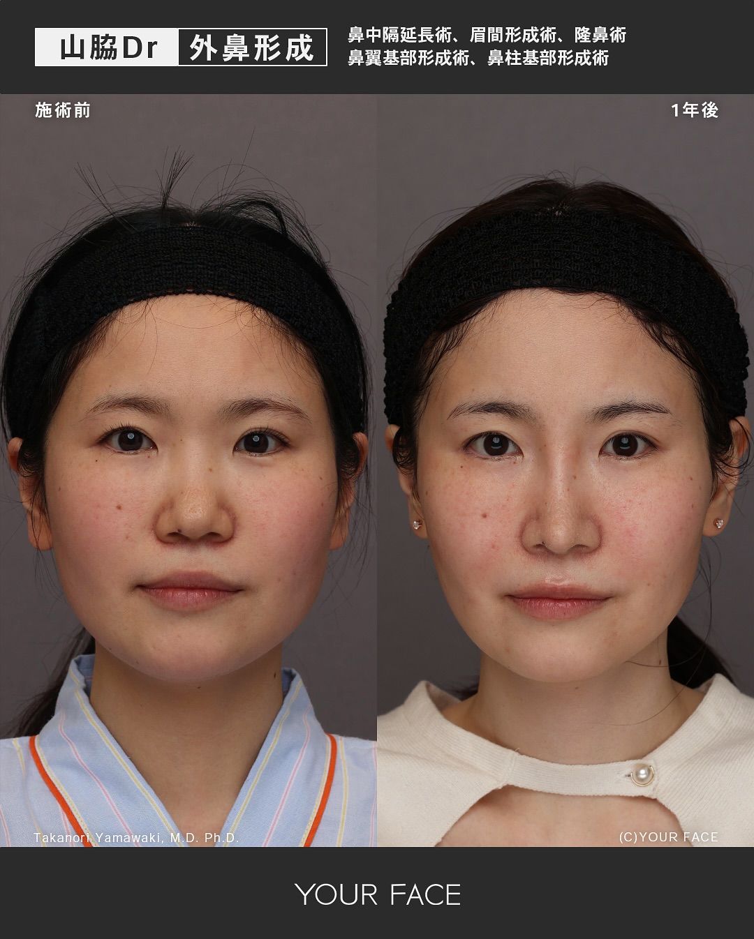 鼻